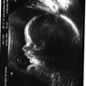 truus1978