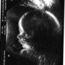 truus1978